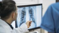 Doctors analyzing radiological chest x-ray film during CODIV-19 pandemic.